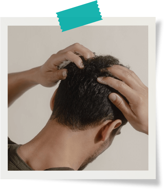 Hair Loss or Thinning