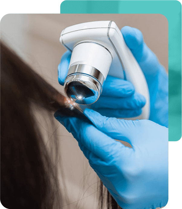 Anti-Hair Loss Therapy