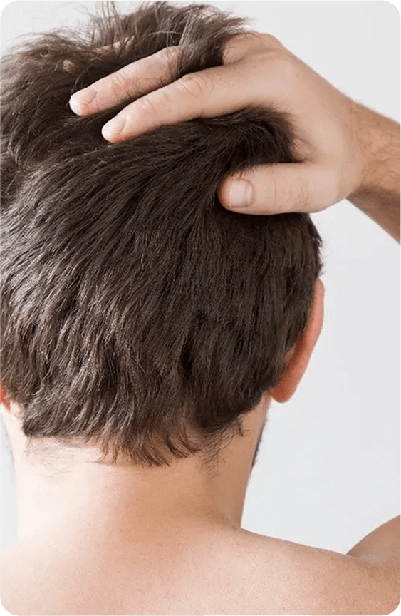 Thinning Hair Therapy