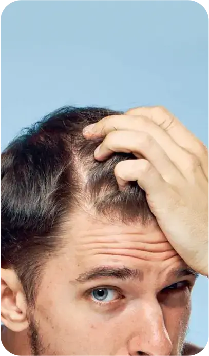 Thinning hair or weak follicles